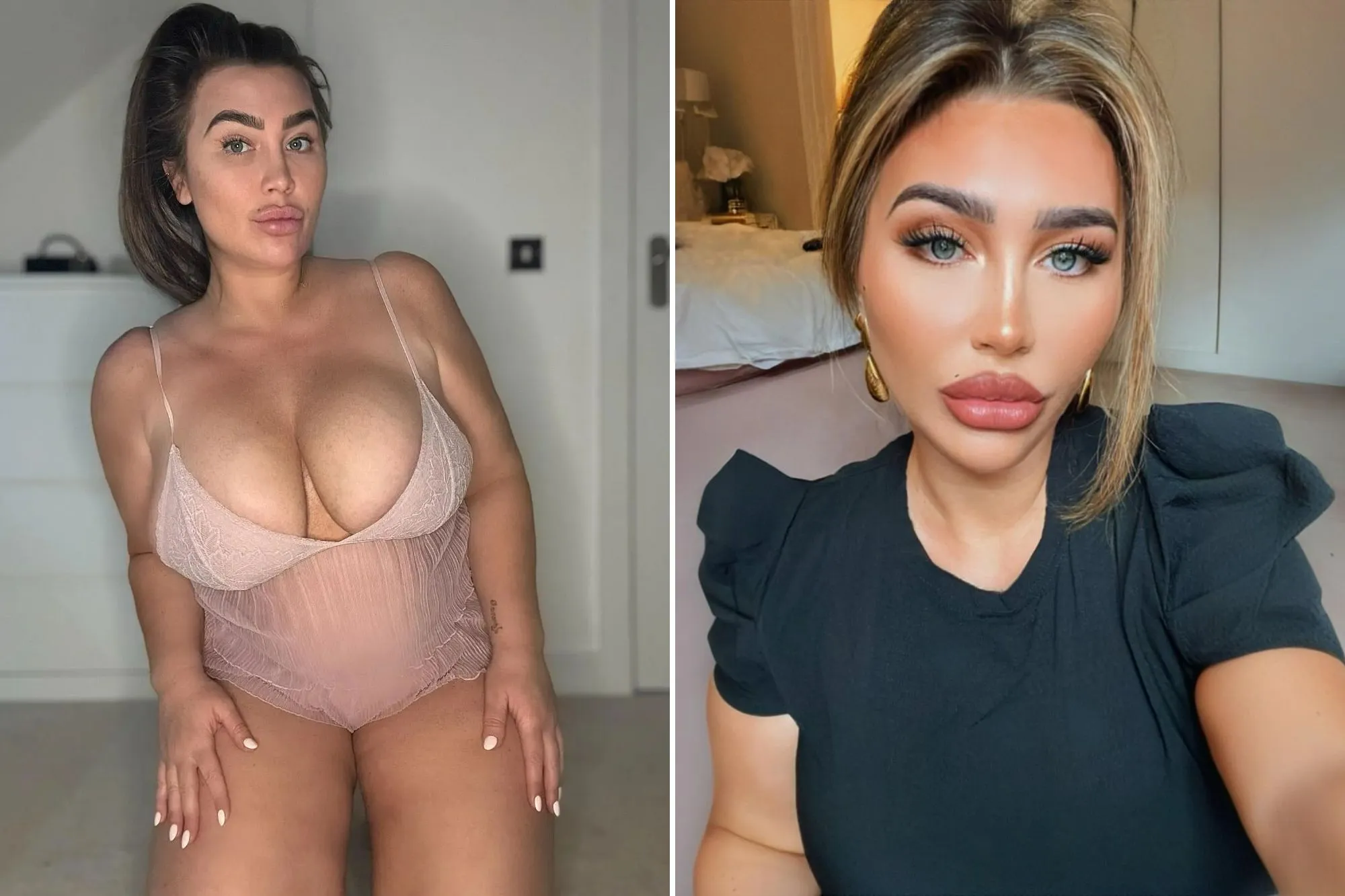Lauren Goodger Opens Up: Why She’s Reversing Surgery for a Natural Look