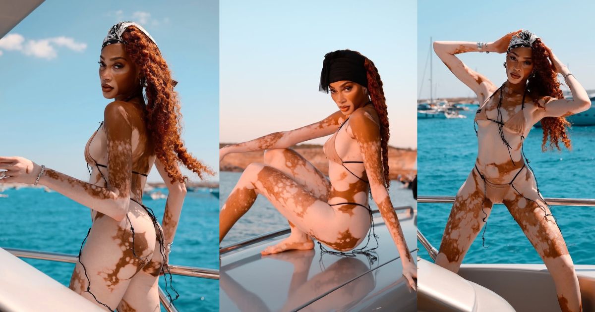 Winnie Harlow Brings Glamour and Glow to Ibiza in Stunning Bikini Moments